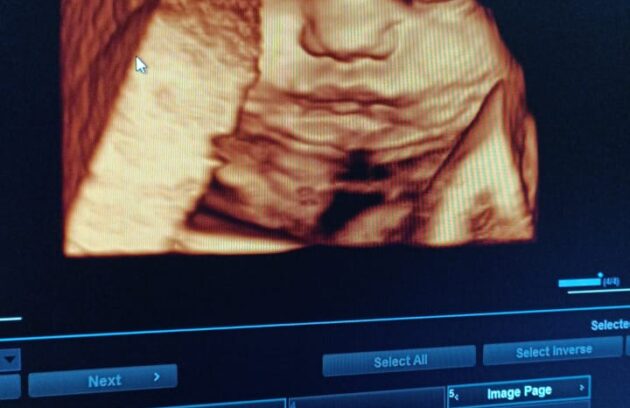 WhatsApp-Image-2022-07-14-at-10.24.41-AM-630x408