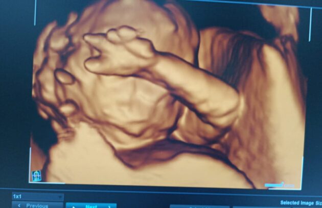 WhatsApp-Image-2022-07-14-at-10.24.42-AM-630x408