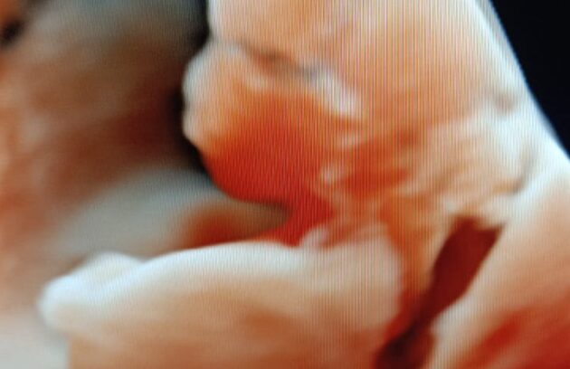 WhatsApp-Image-2022-07-14-at-10.24.43-AM-630x408