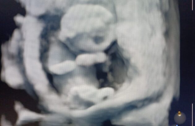 WhatsApp-Image-2022-07-14-at-10.24.44-AM-630x408