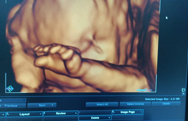 WhatsApp-Image-2022-07-14-at-10.24.46-AM-630x408