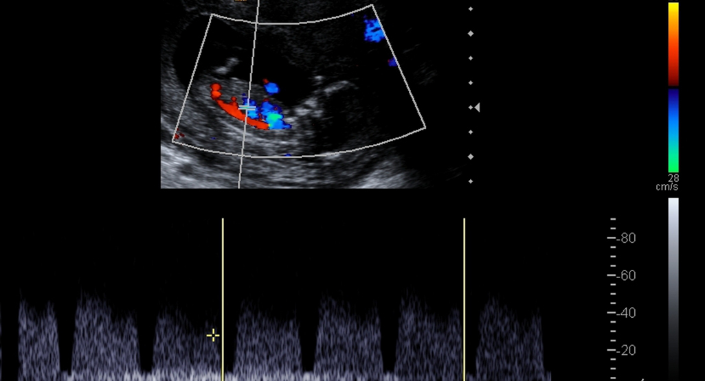 iStock-494084400_wide